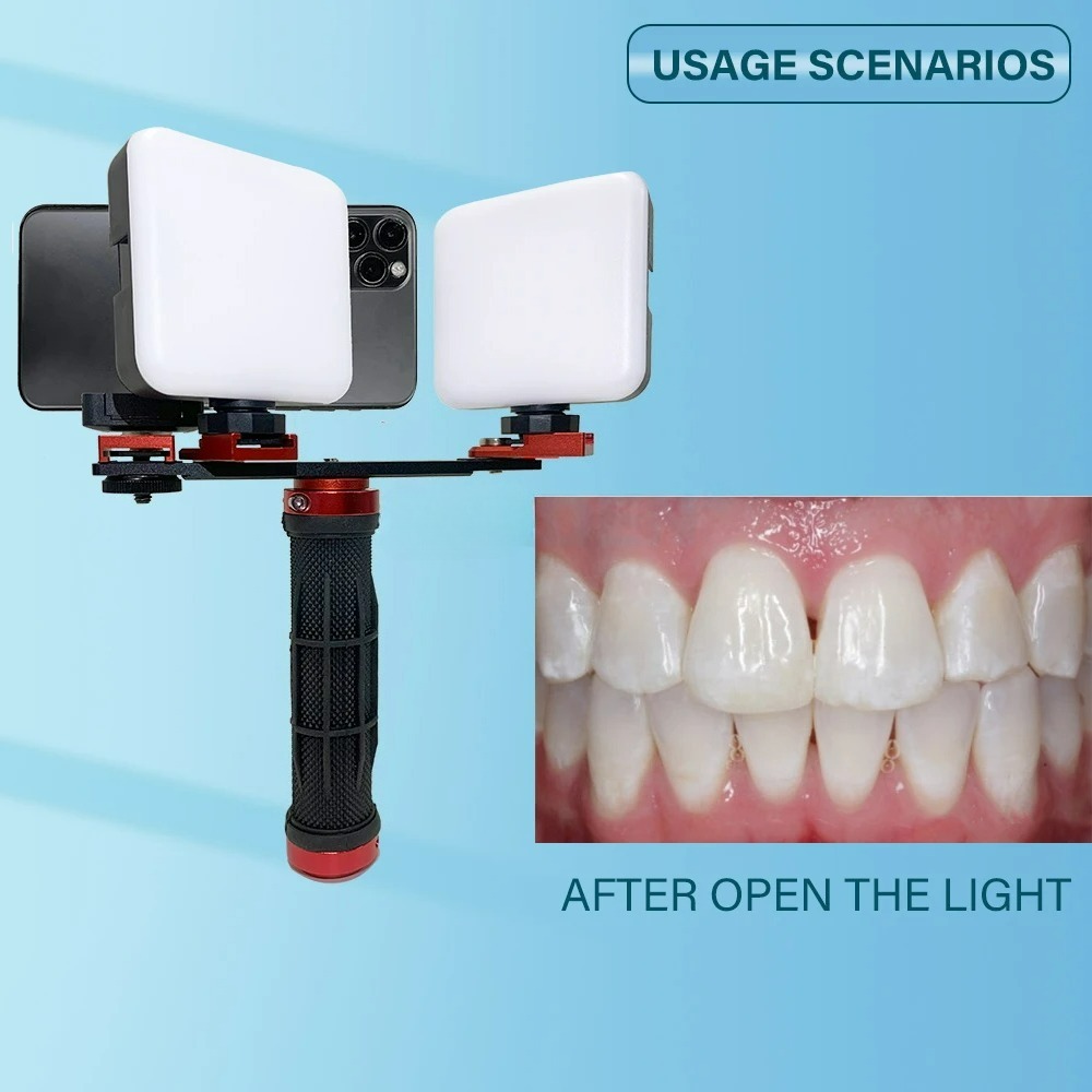 Dental Photography Light Phone - огляд і ціна Photography Lighting Accessories