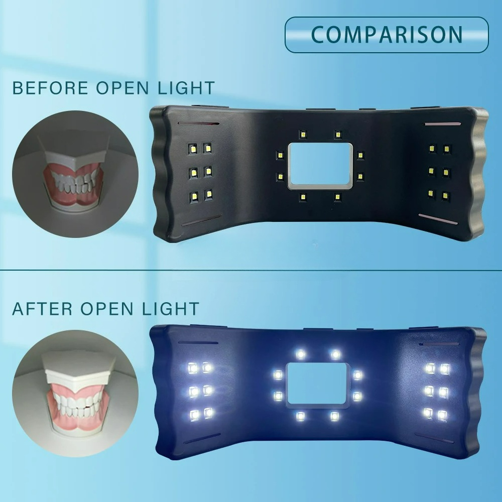 Dental Photography Light Phone - огляд і ціна Photography Lighting Accessories